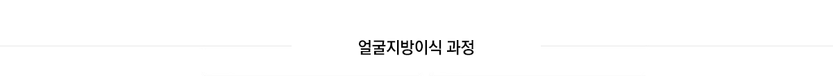 얼굴지방이식 과정